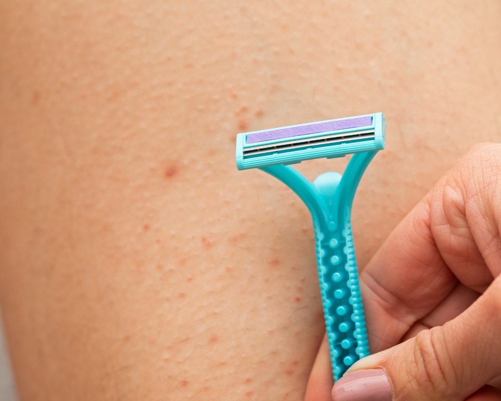 Autocuidados para Foliculite: 5 Dicas que Funcionam autocuidados para foliculite 02